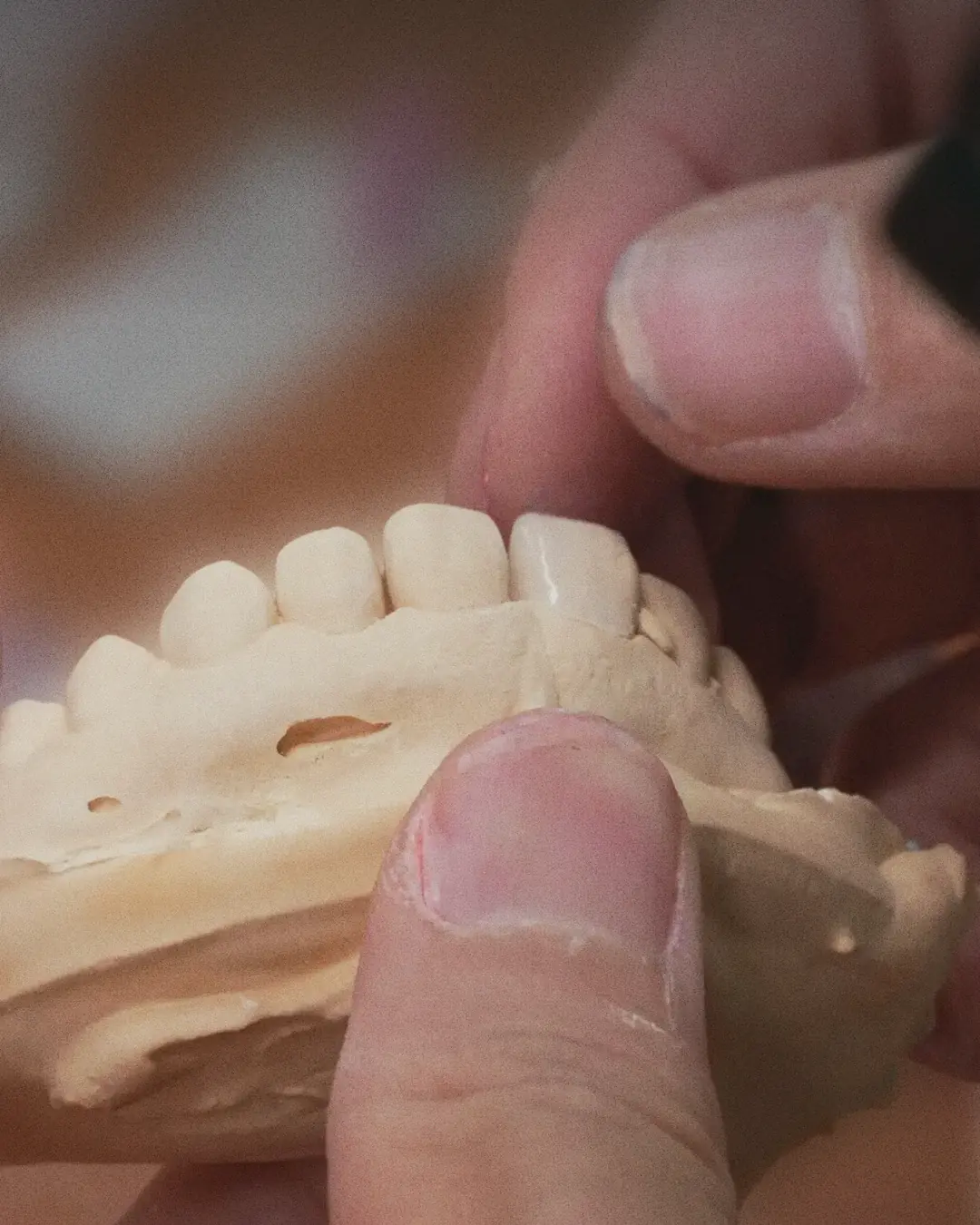 Hands finishing the front teeth on a stone model