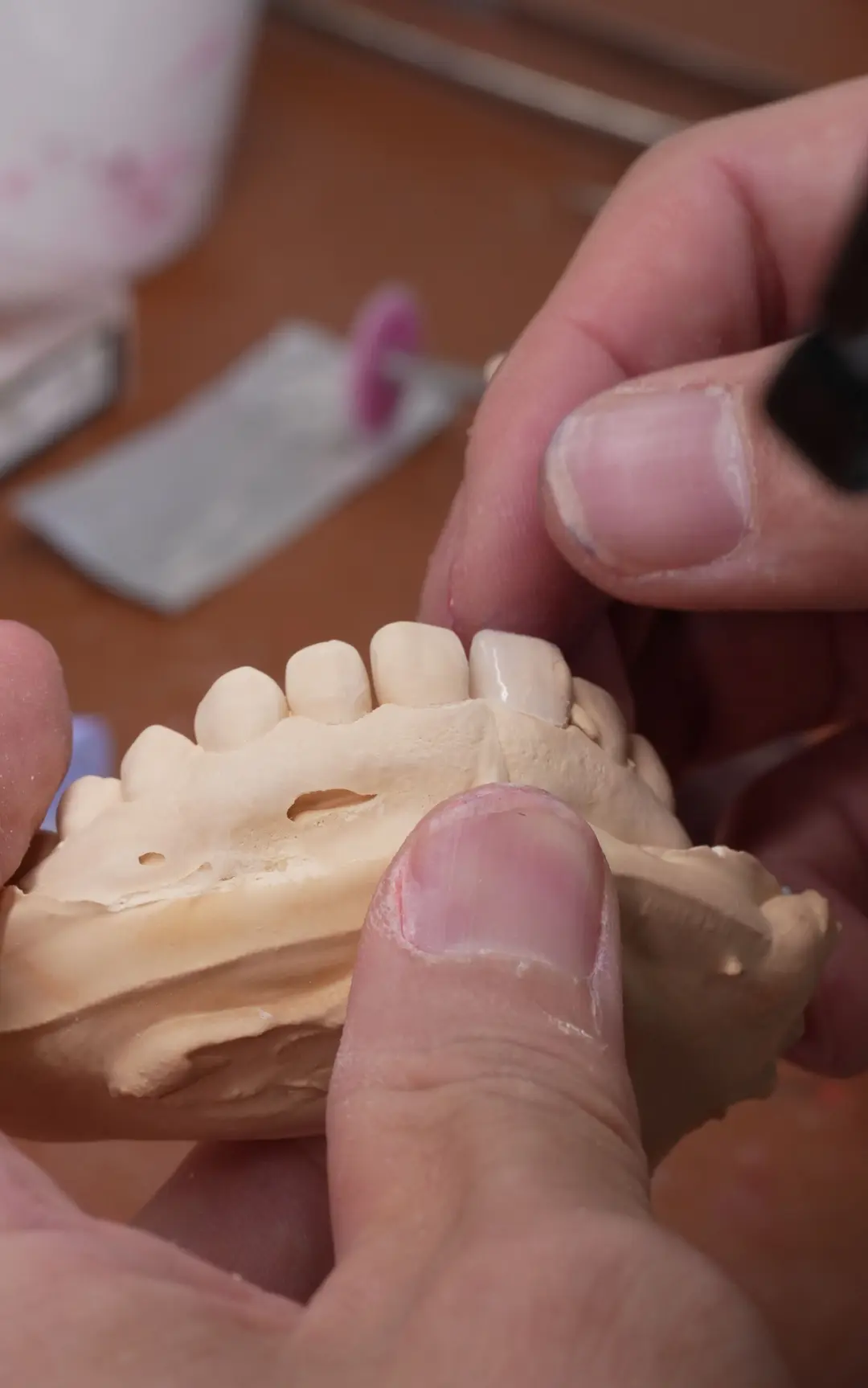 Hands finishing the front teeth on a model over a warm bench