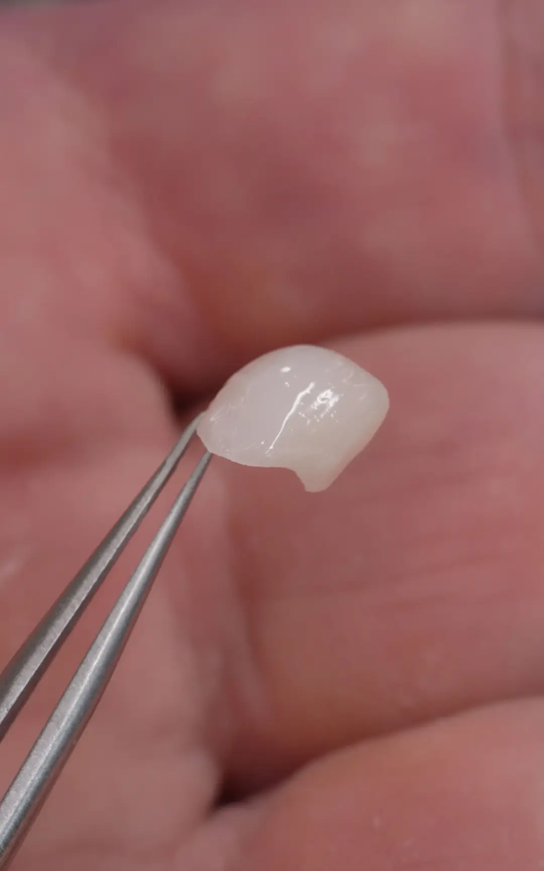 A finished veneer held in fine tweezers over an open palm