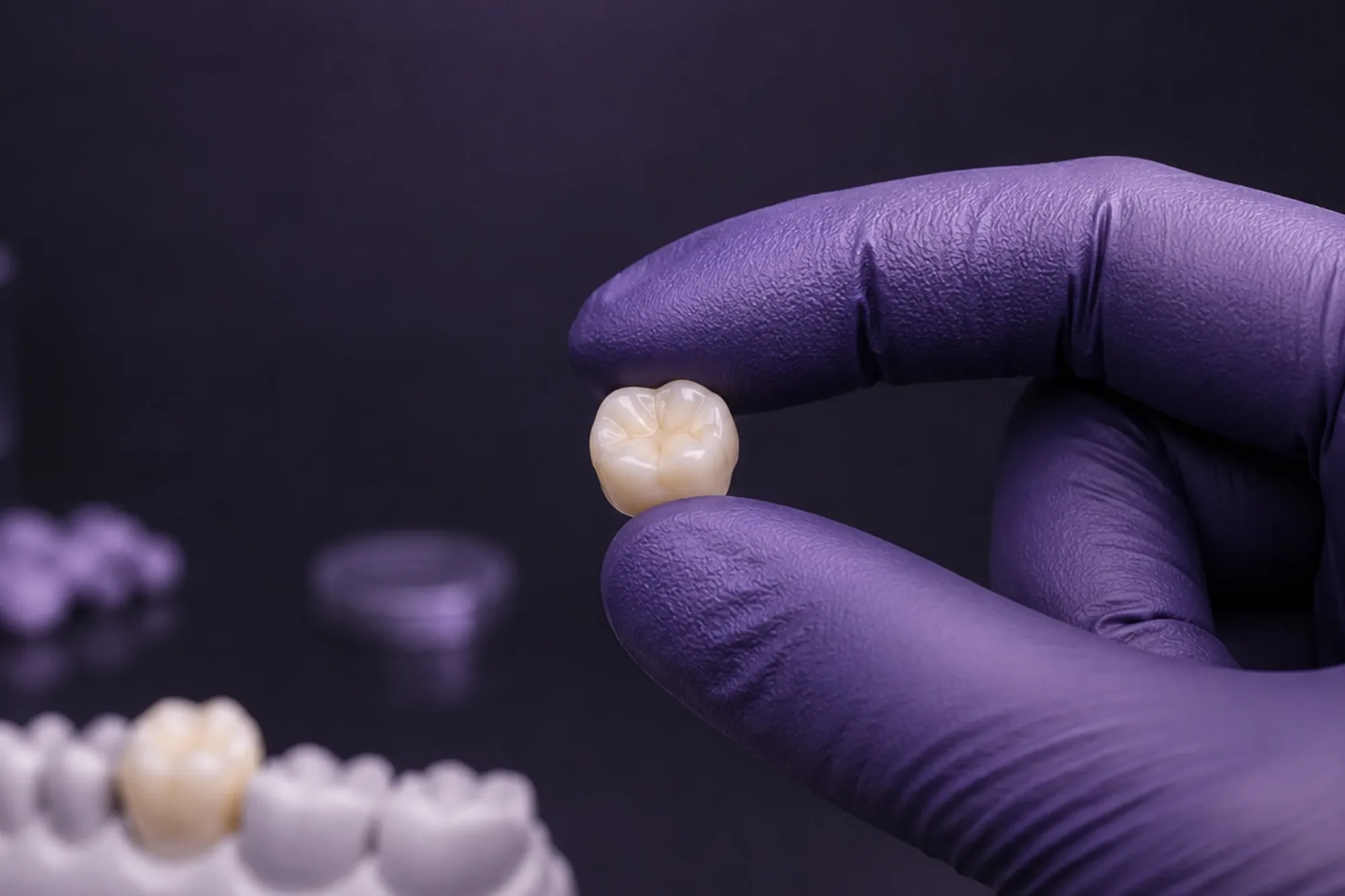 A finished molar crown held at true scale between two gloved fingertips, the master model waiting behind it