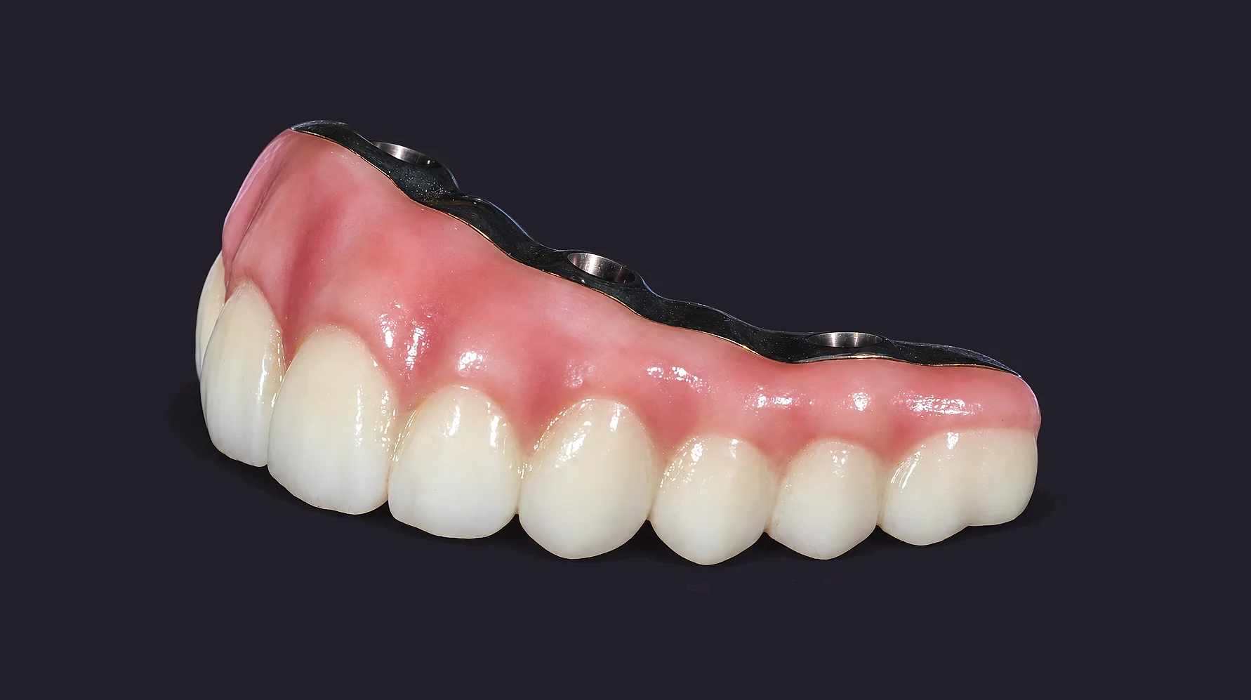 A finished full-arch zirconia bridge from the side, the gum shaded along every tooth