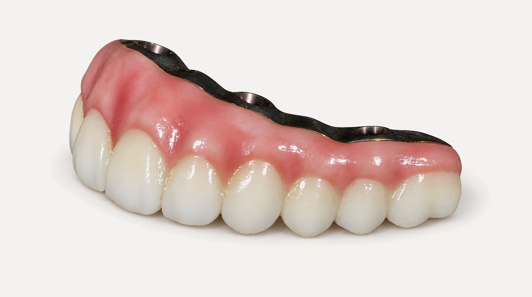 A finished full-arch zirconia bridge from the side, the gum shaded along every tooth