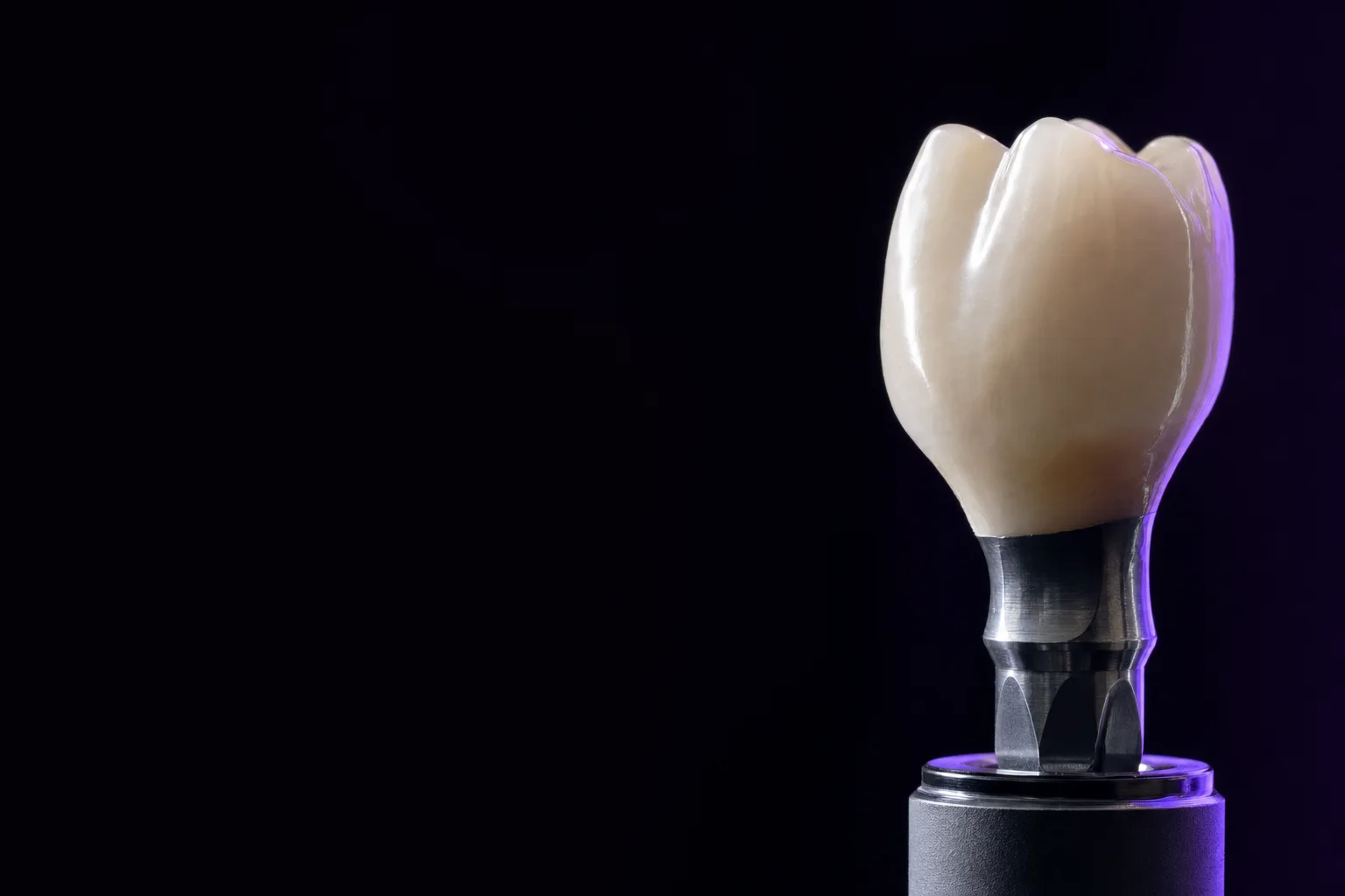 Implant Crown + Custom Abutment