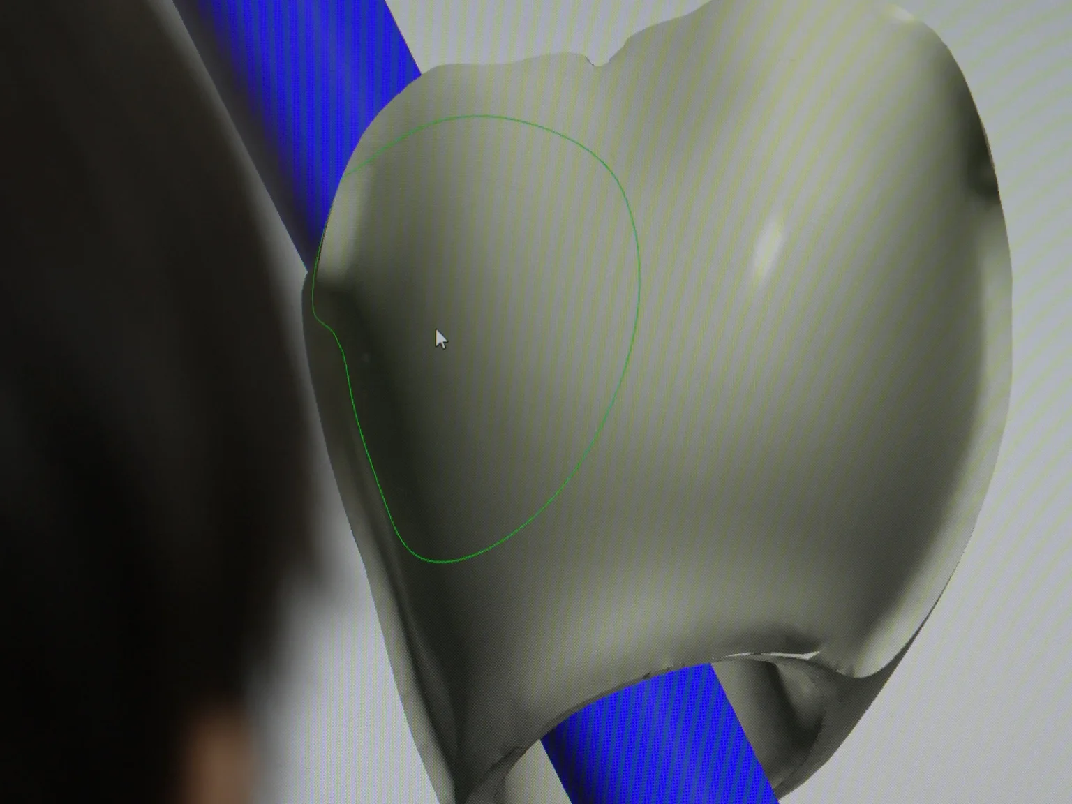 A master at the CAD screen, the screw channel drawn as a blue cylinder angled through the crown design