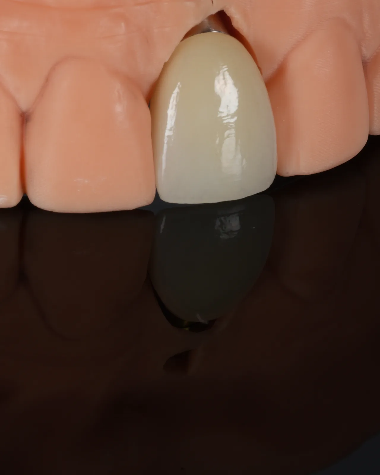 A single layered anterior crown seated on its model, reflected in the black ground