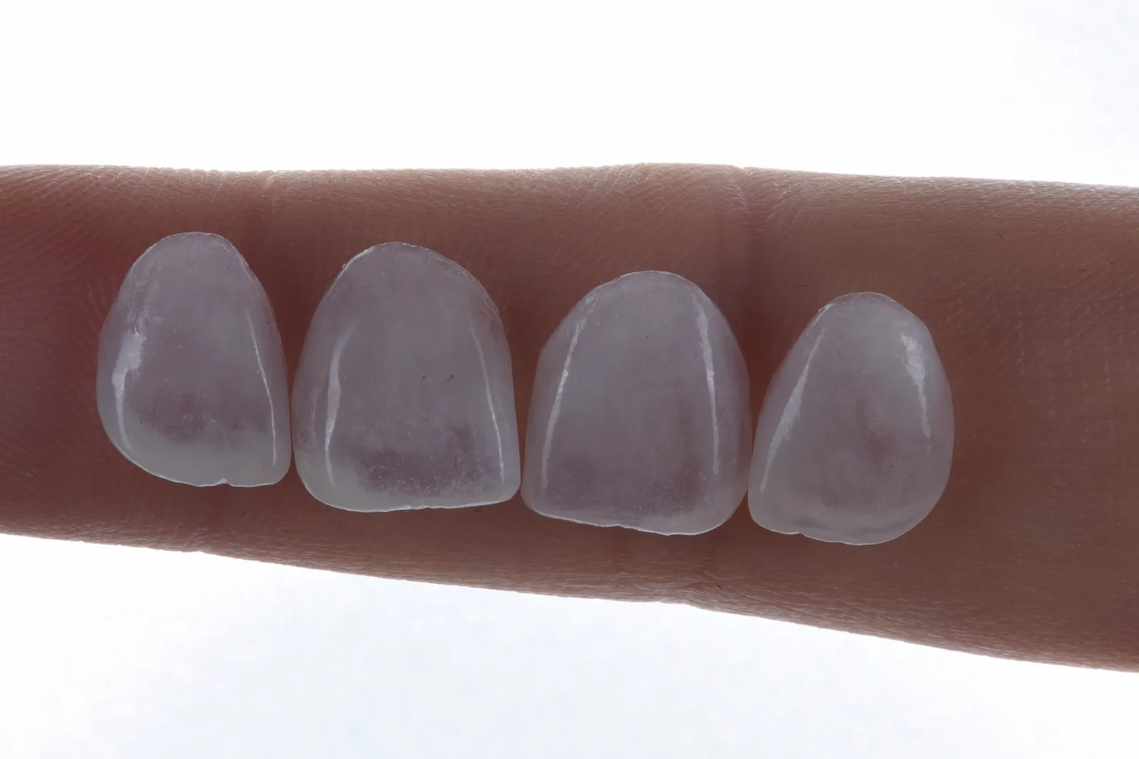 Four feldspathic veneers resting on a fingertip against bright daylight, the finger visible through them