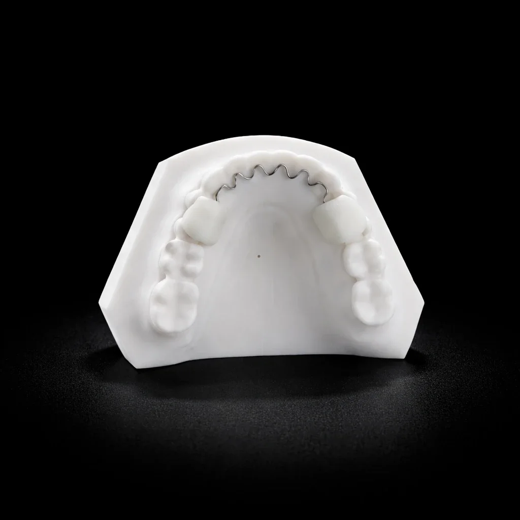 A lingual fixed retainer bonded behind the front teeth of a white model