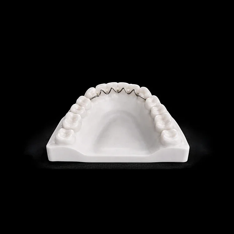A V-loop fixed retainer bonded behind the front teeth of a white model