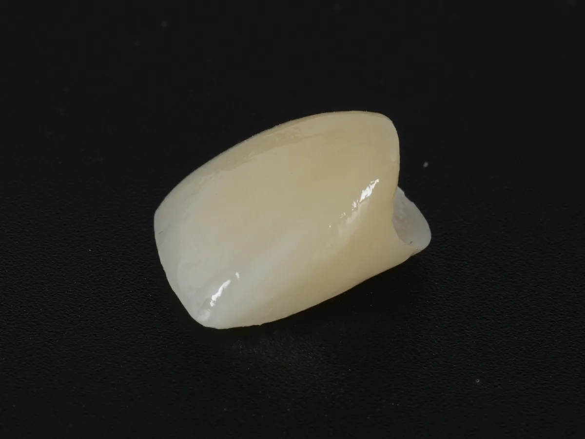 A porcelain-on-zirconia front crown on a black ground