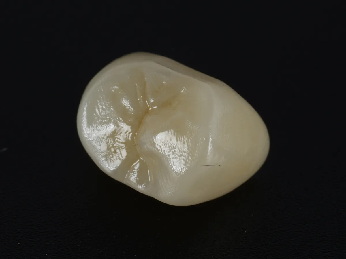 A monolithic zirconia molar crown seen from the biting surface, on a black ground