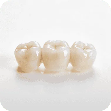 The  Implant Crown: How We Cut Costs Without Cutting Corners