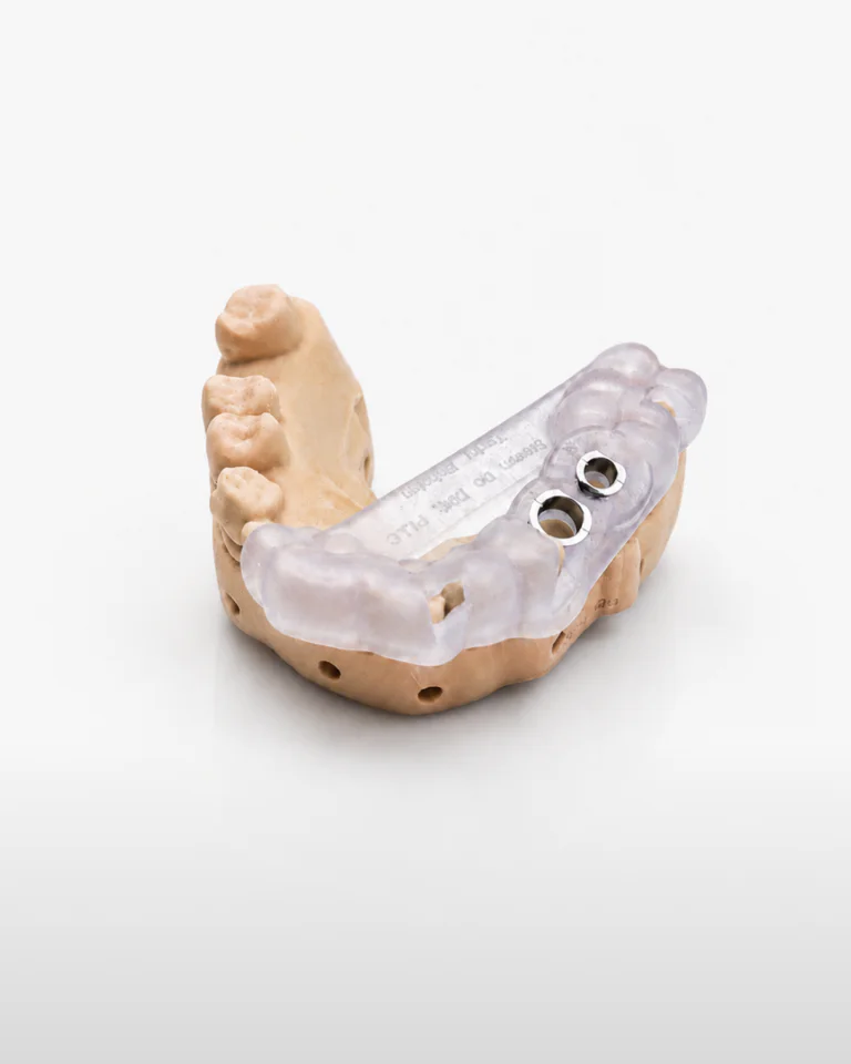 Implant Guides