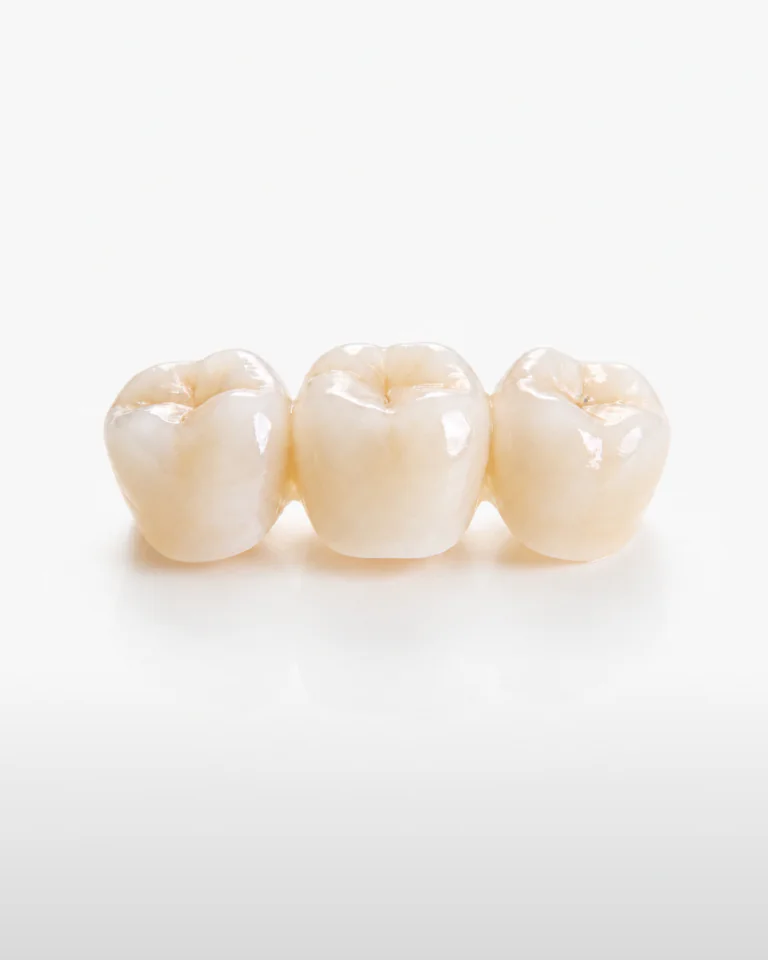 Restorations