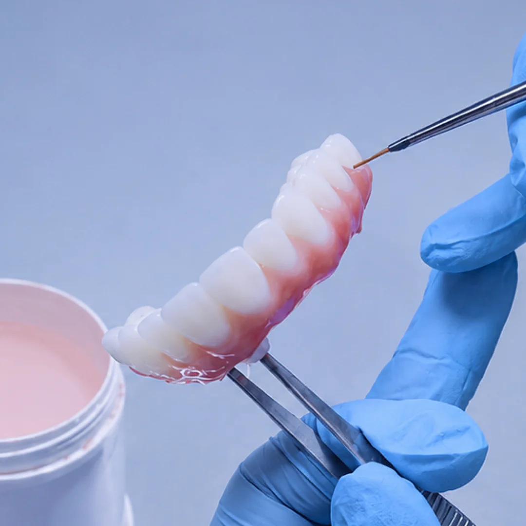 All-on-X prosthetic detailed by a Dentlink technician
