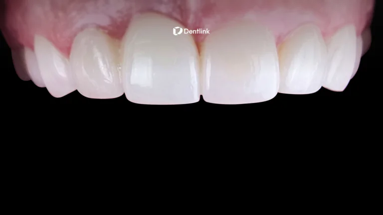 Patient confidence after restorative dentistry case