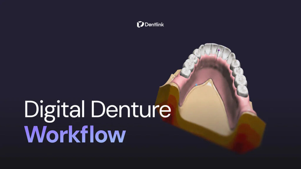 Digital Denture Workflow: From CAD/CAM to Final Finish