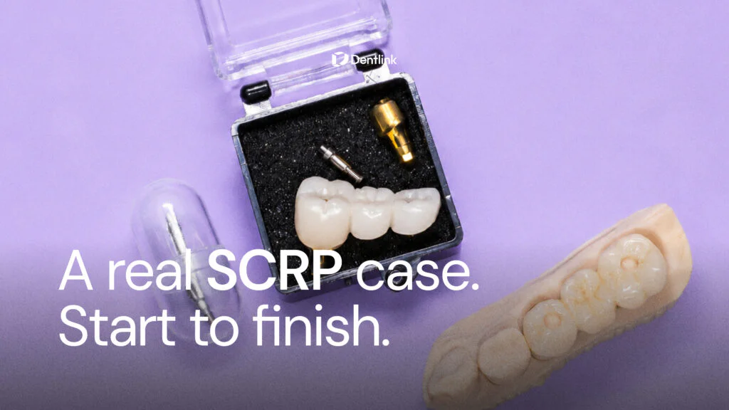 How Screwmentable Restorations (SCRP) Improve Challenging Implant Cases: A Proven Clinical Workflow