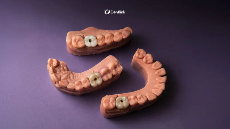 Why Dentists Refer Their Dental Lab: Less Chair Time, Fewer Adjustments