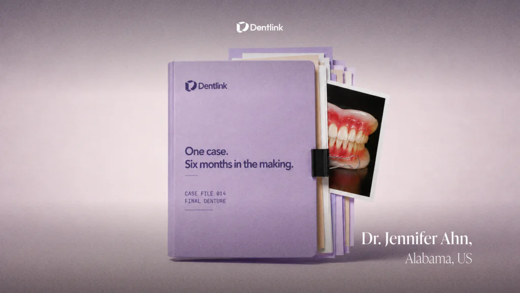 Digital Denture Case Review: A 6-Month Journey from Wax Try-In to Final Denture