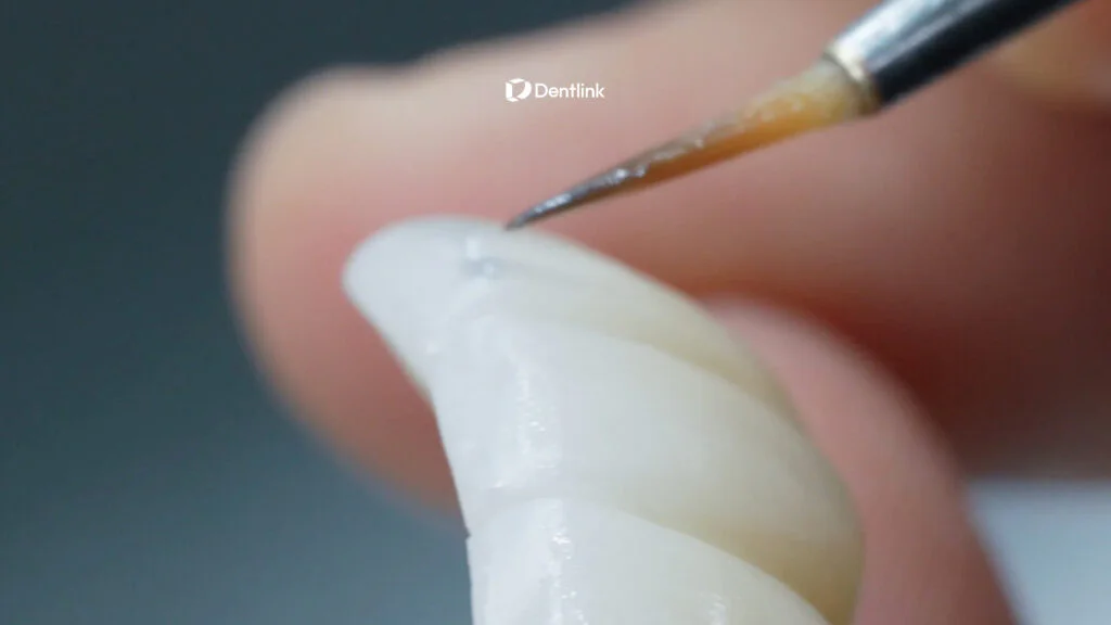 What Makes a Dental Restoration Look Natural?