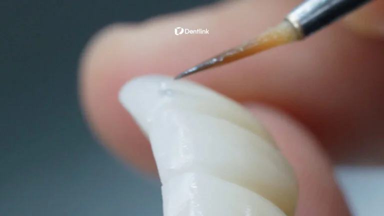 Dental technician coloring staining and glazing a dental restoration