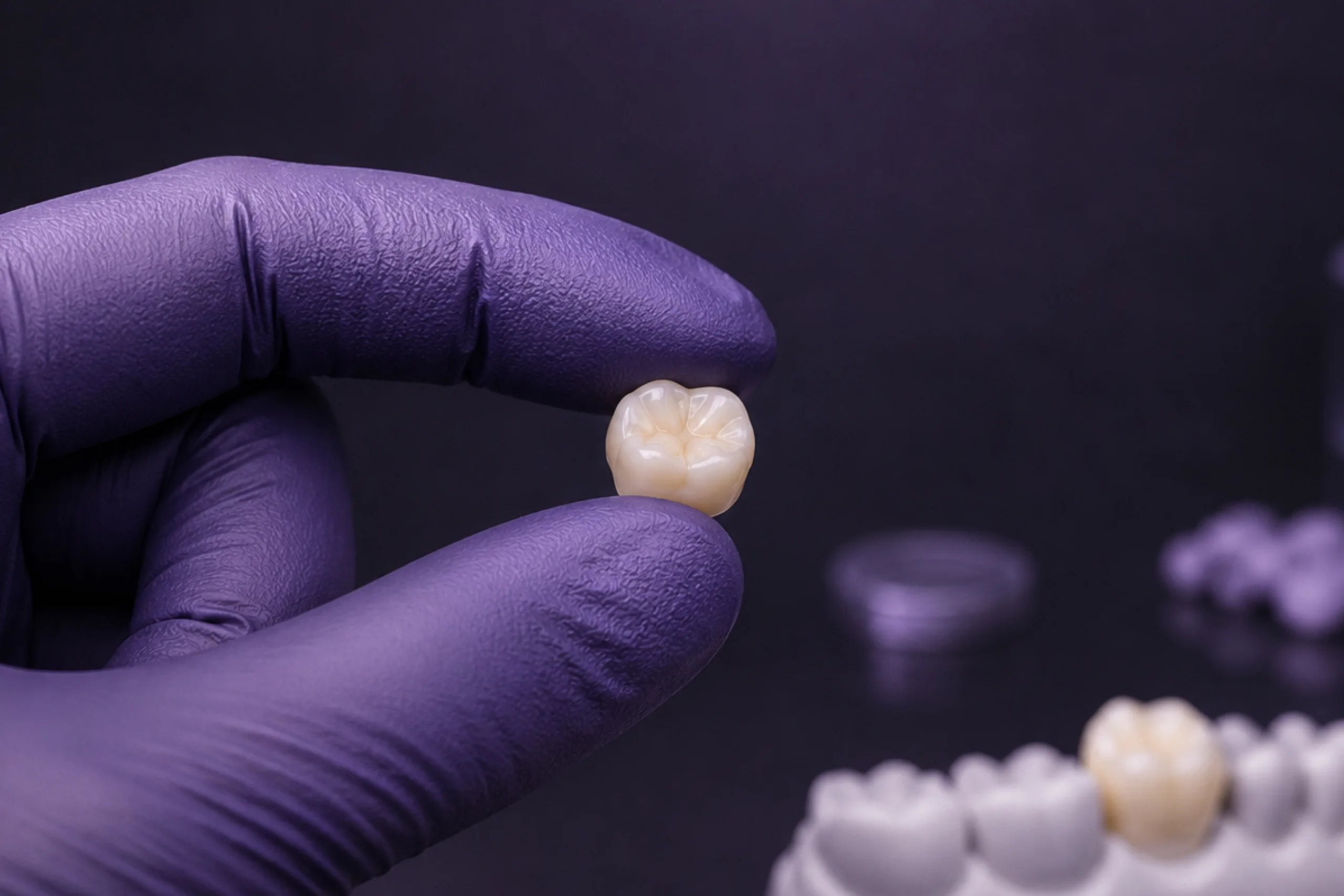 A finished molar crown held between two gloved fingertips