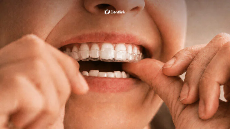 Dentlink dental nightguard for patients