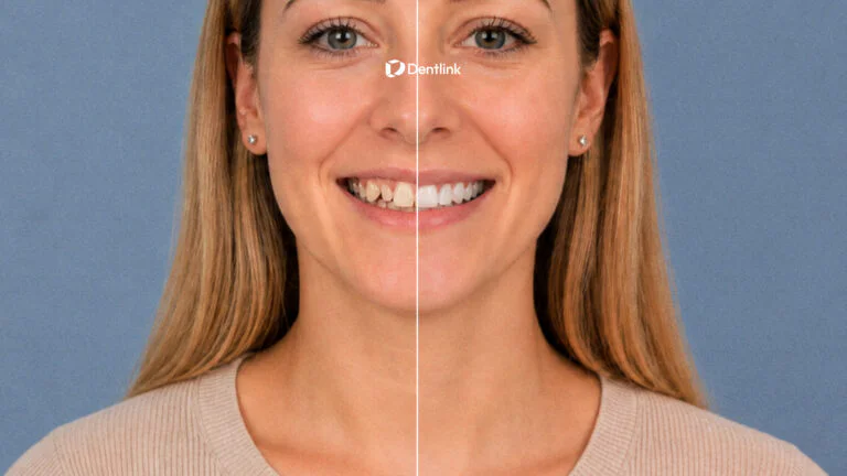 ISV smile simulation for dentists showing a cosmetic smile before-and-after preview