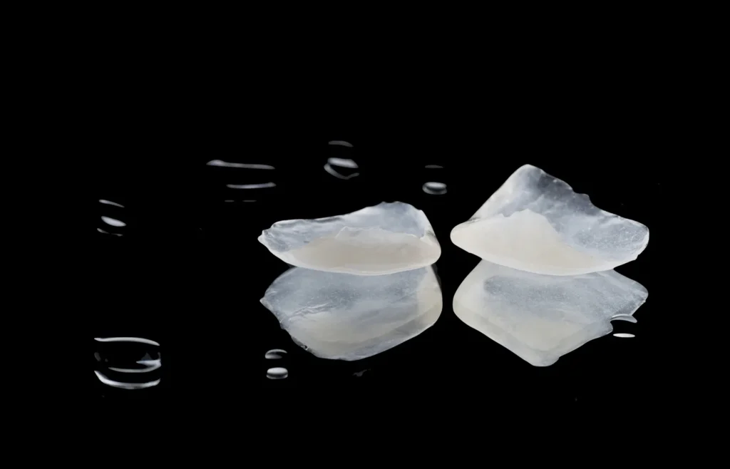 Choosing Feldspathic Porcelain Veneers: Esthetics & Workflow