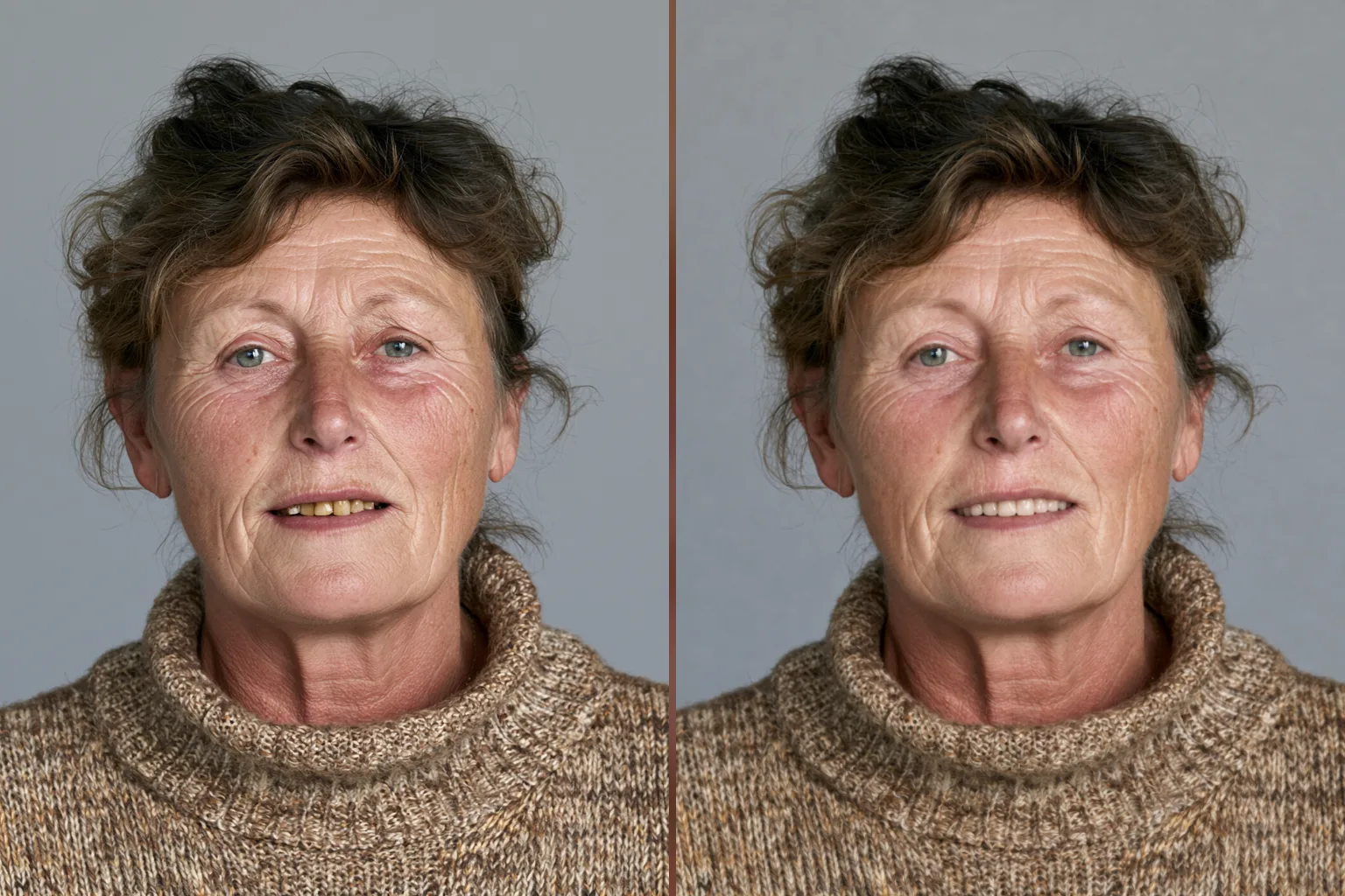 A woman in a sweater, her photo beside her Insta Smile Vision preview